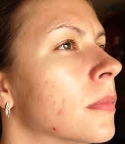 аллергическая реакция кожи