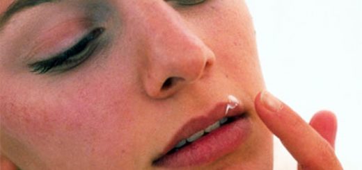 как лечить герпес