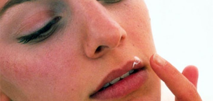 как лечить герпес