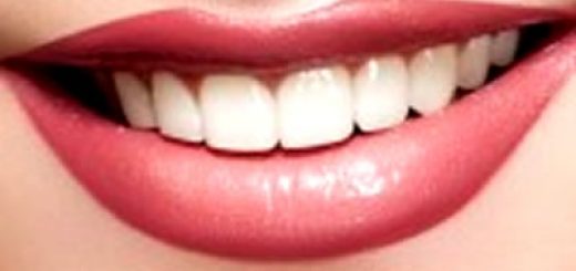 восстановление зубов