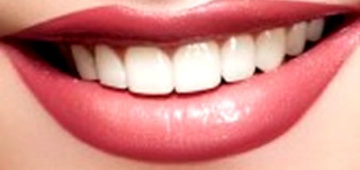 восстановление зубов