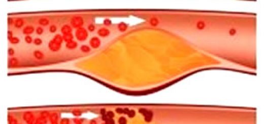 холестерин