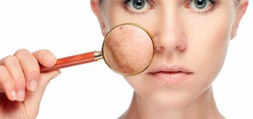 обезвоженная кожа