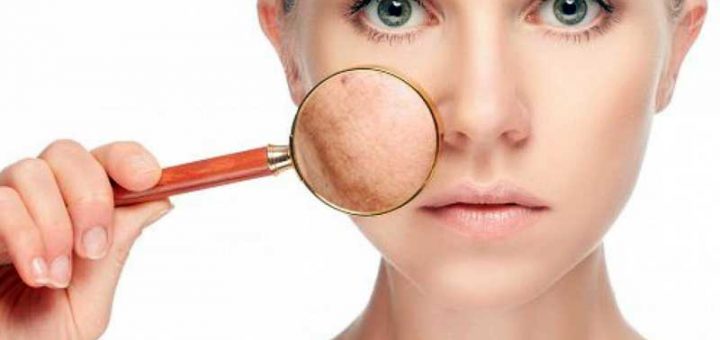 обезвоженная кожа