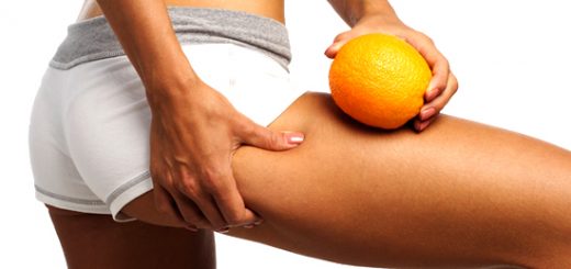 история возникновения целлюлита