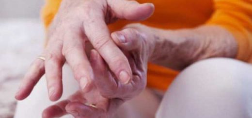 ревматоидный артрит